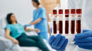 blood test