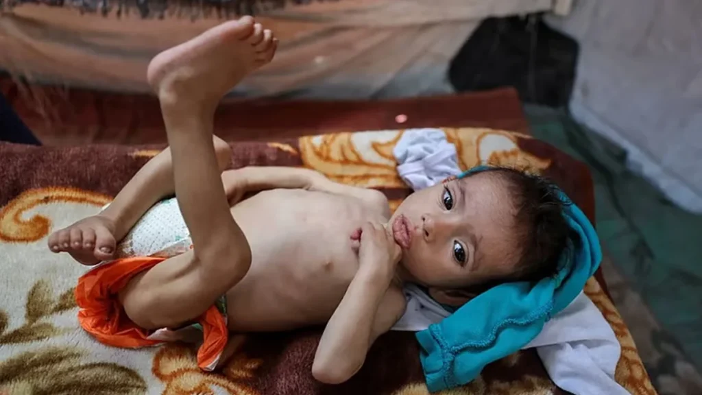 gaza baby