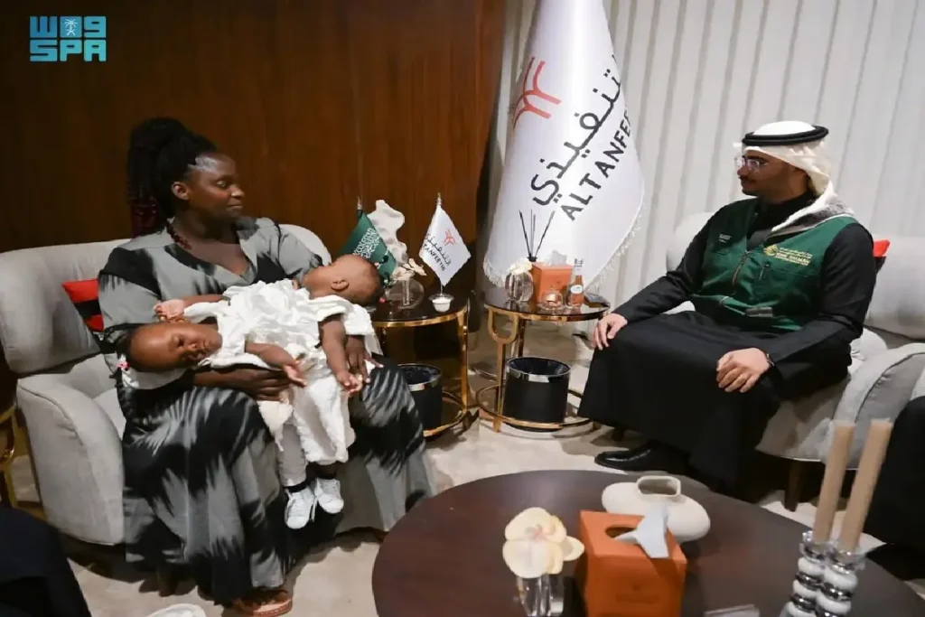 ശസ്ത്രക്രിയക്കായി ടാന്സാനിയയില് നിന്ന് രണ്ടു സയാമിസ് ഇരട്ടകള് കൂടി സൗദിയില്